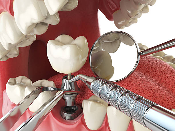 Best Tooth Infection Emergency Dentist  in Virginia, IL